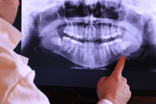Best Emergency Gum Treatment in Aventura, FL